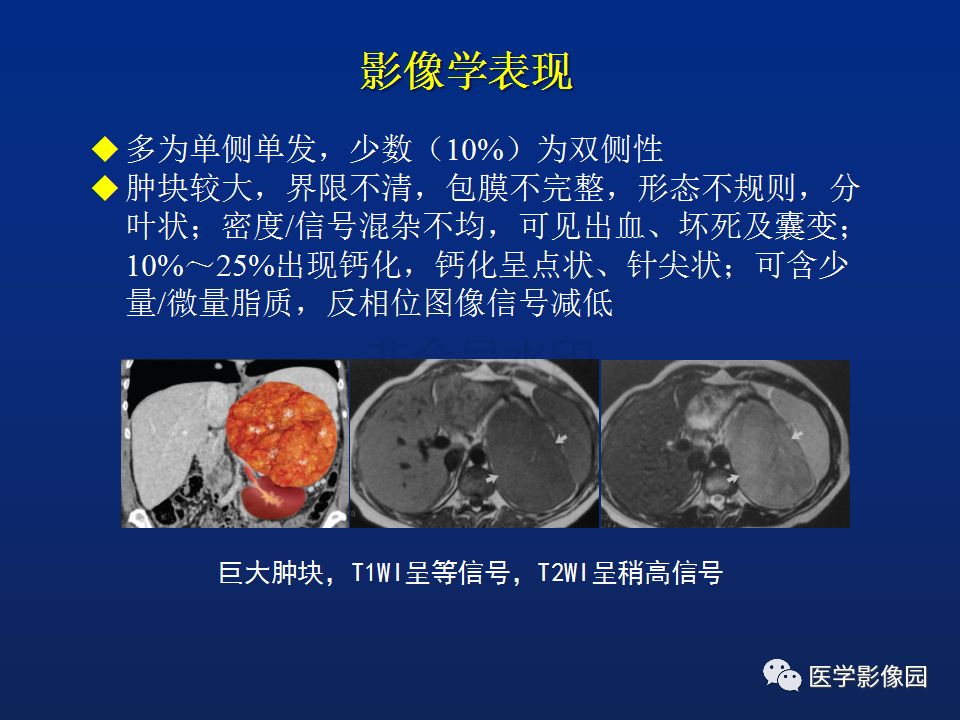 【PPT】肾上腺疾病的影像学表现