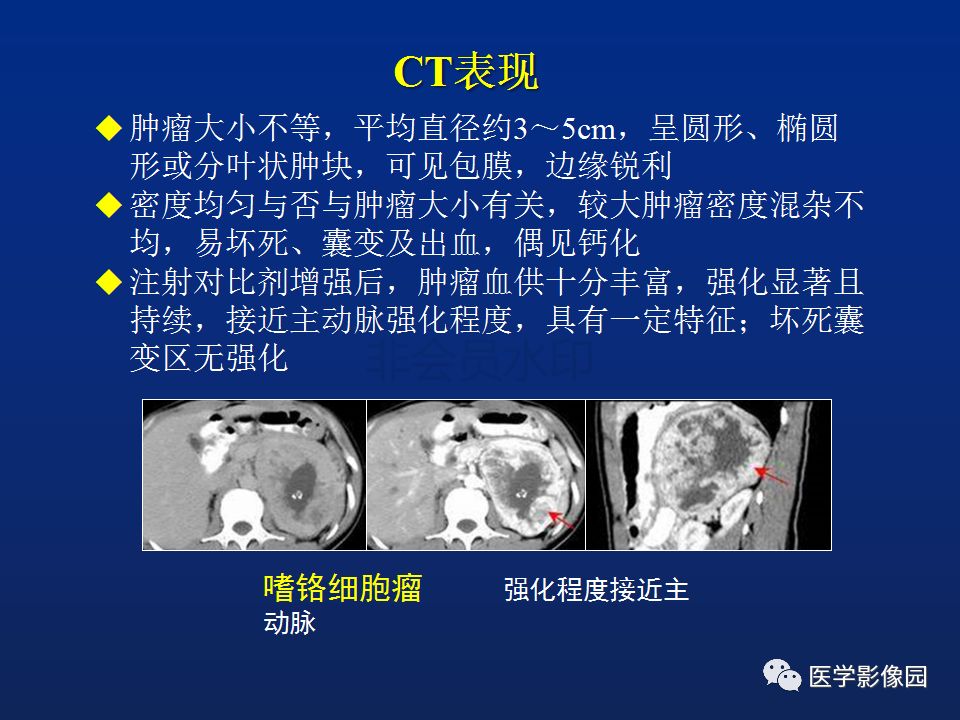 【PPT】肾上腺疾病的影像学表现