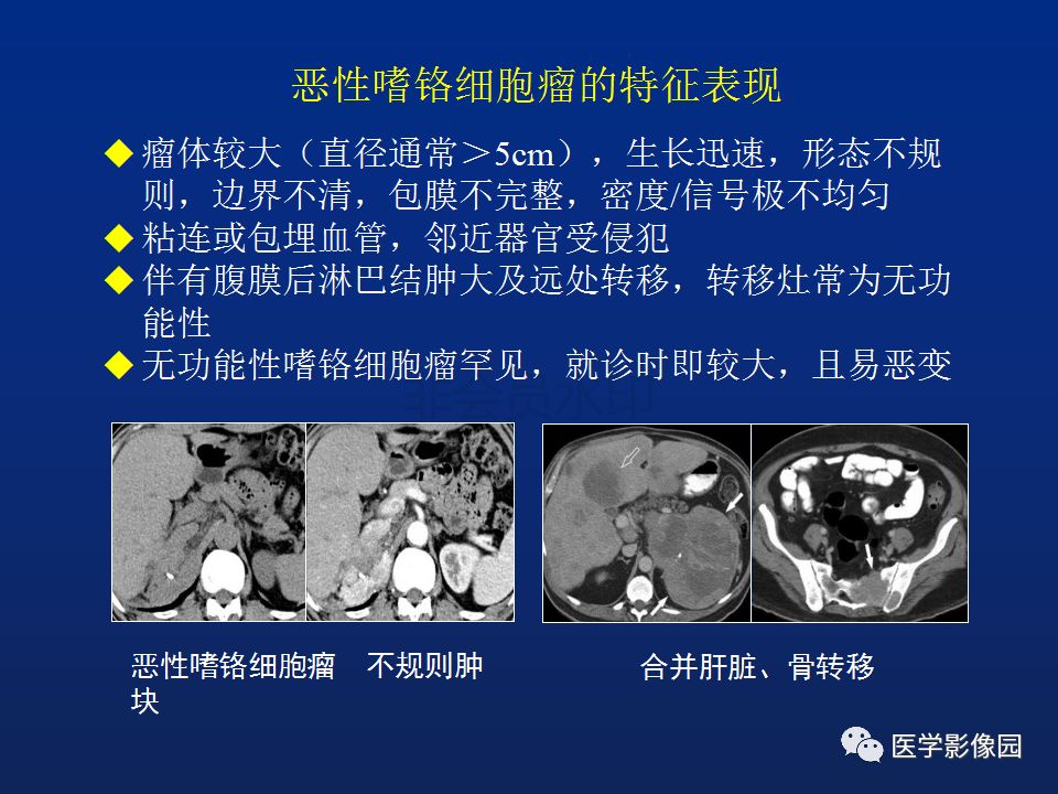 【PPT】肾上腺疾病的影像学表现