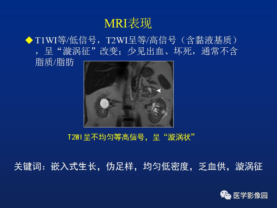 【PPT】肾上腺疾病的影像学表现