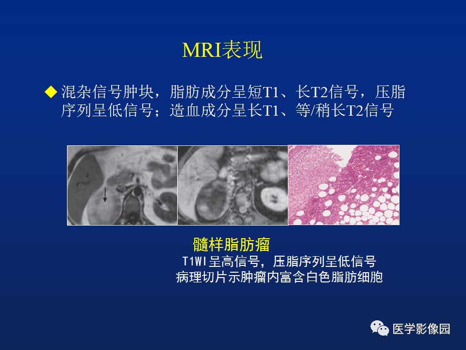 【PPT】肾上腺疾病的影像学表现