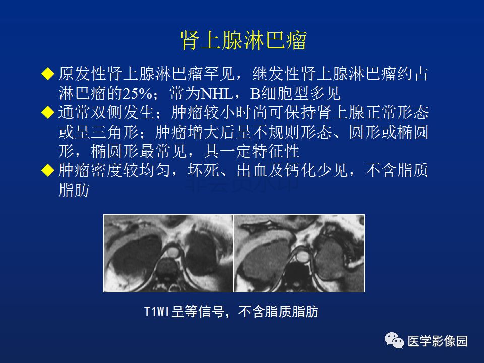 【PPT】肾上腺疾病的影像学表现