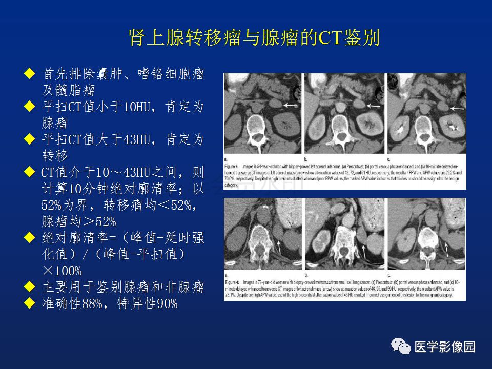 【PPT】肾上腺疾病的影像学表现