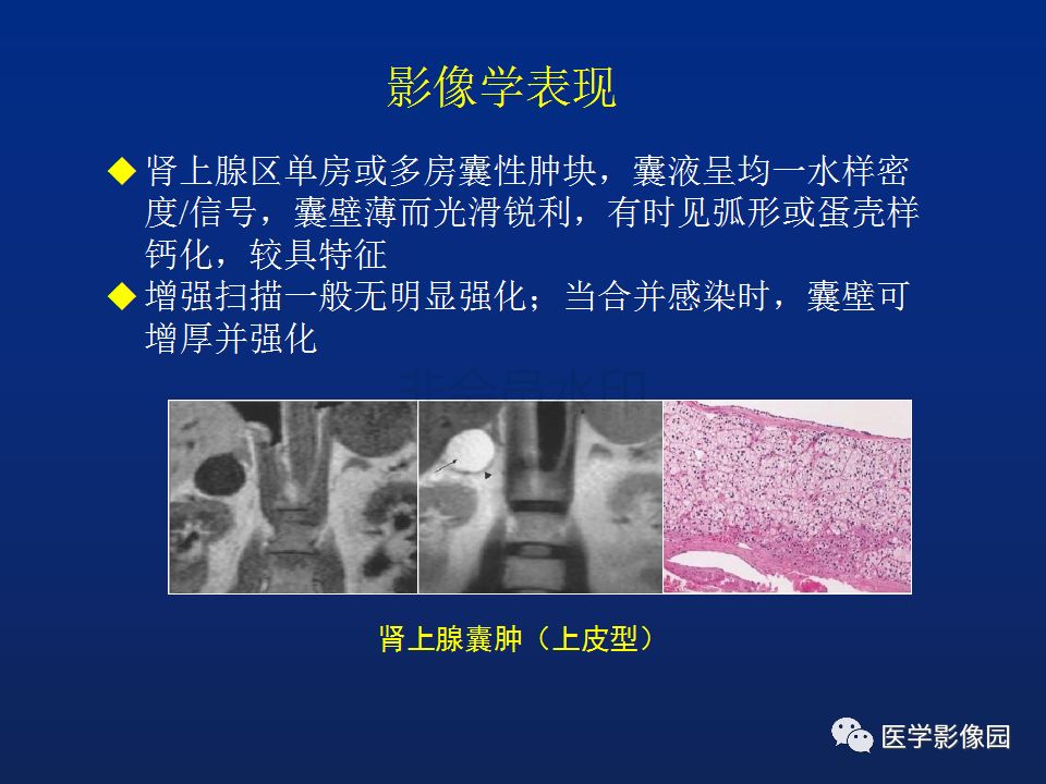 【PPT】肾上腺疾病的影像学表现