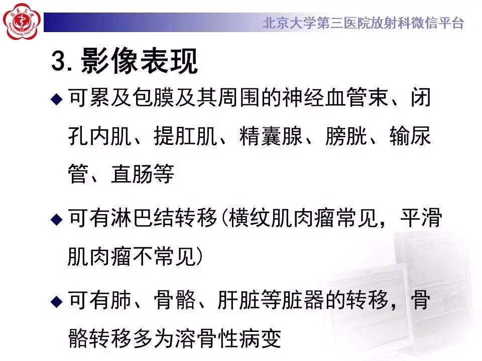 【病例】前列腺肉瘤1例MR