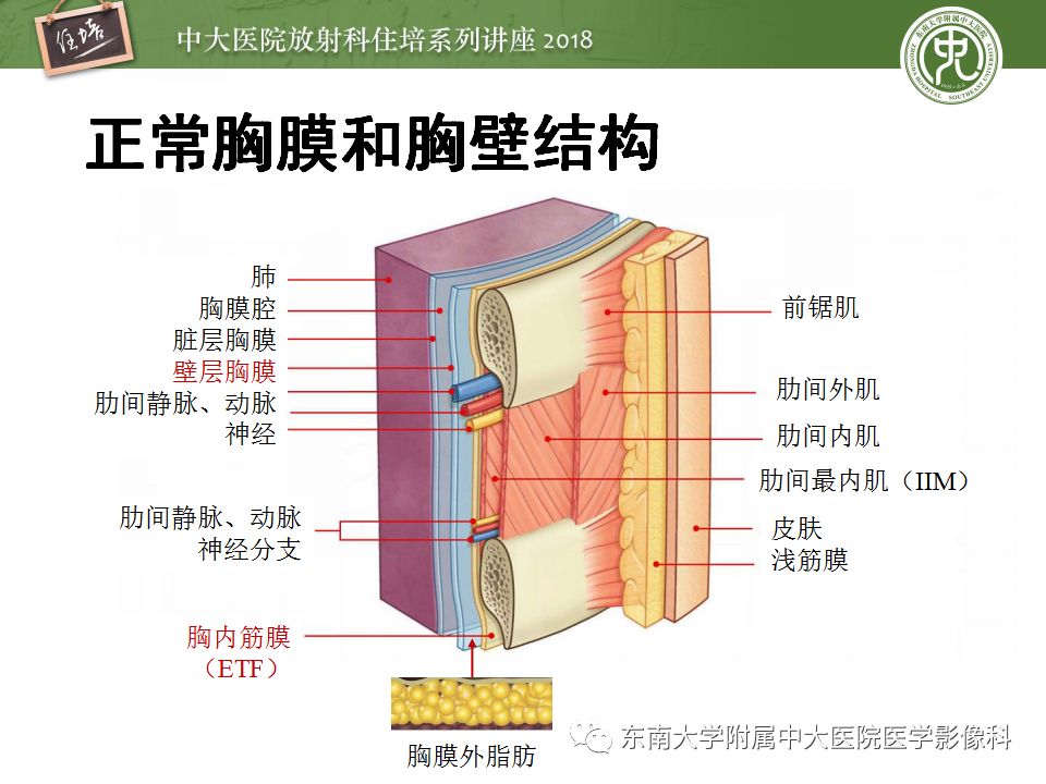 【PPT】胸膜常见疾病的影像诊断