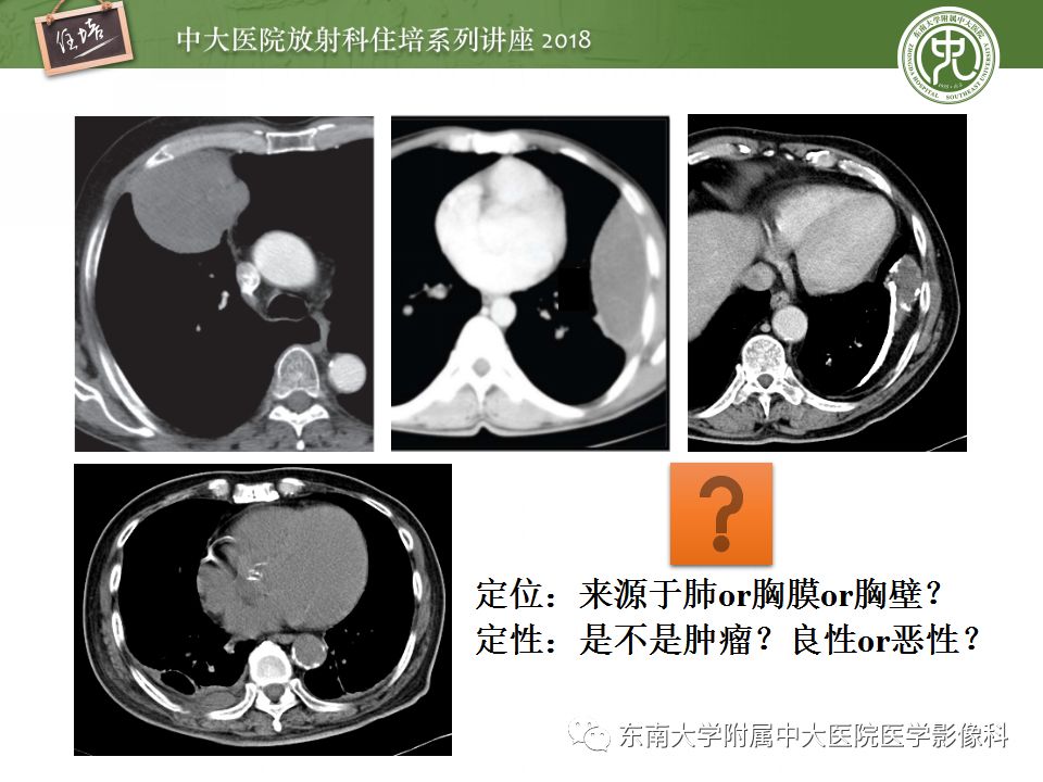 【PPT】胸膜常见疾病的影像诊断