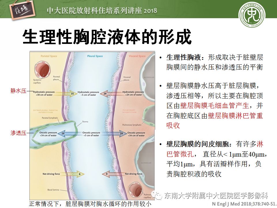 【PPT】胸膜常见疾病的影像诊断