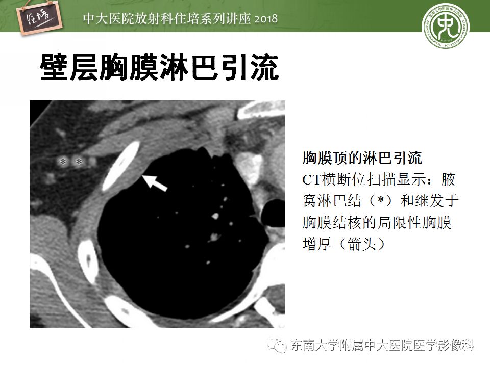 【PPT】胸膜常见疾病的影像诊断
