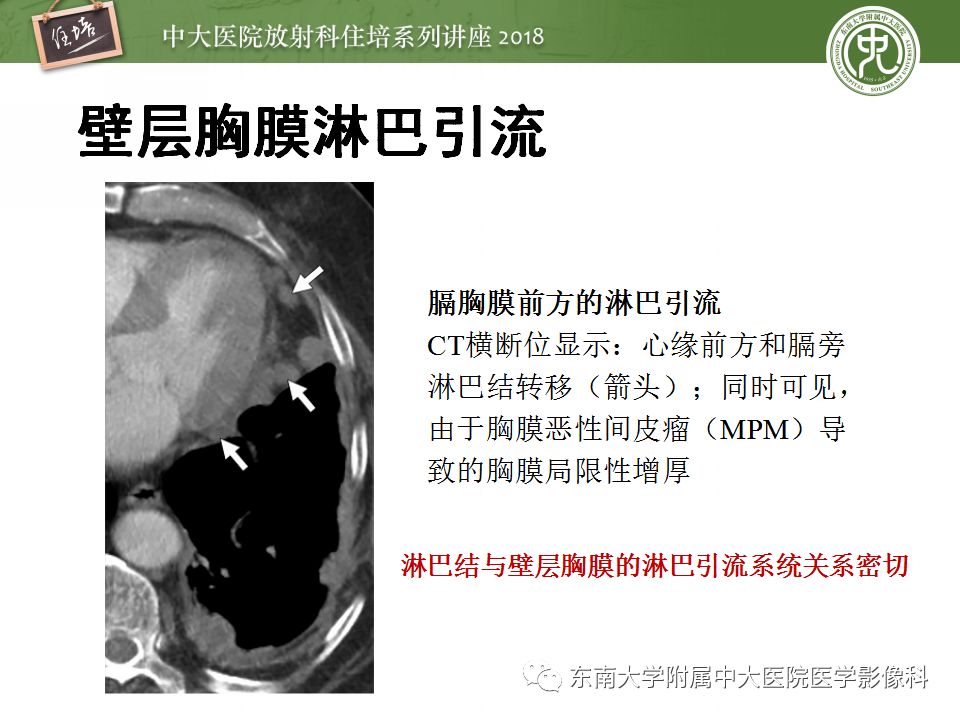 【PPT】胸膜常见疾病的影像诊断