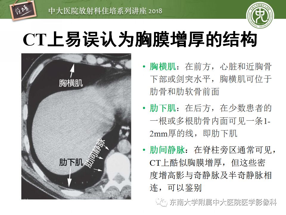 【PPT】胸膜常见疾病的影像诊断