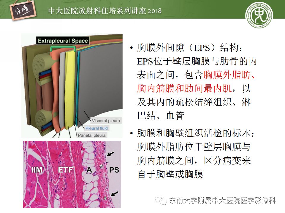 【PPT】胸膜常见疾病的影像诊断