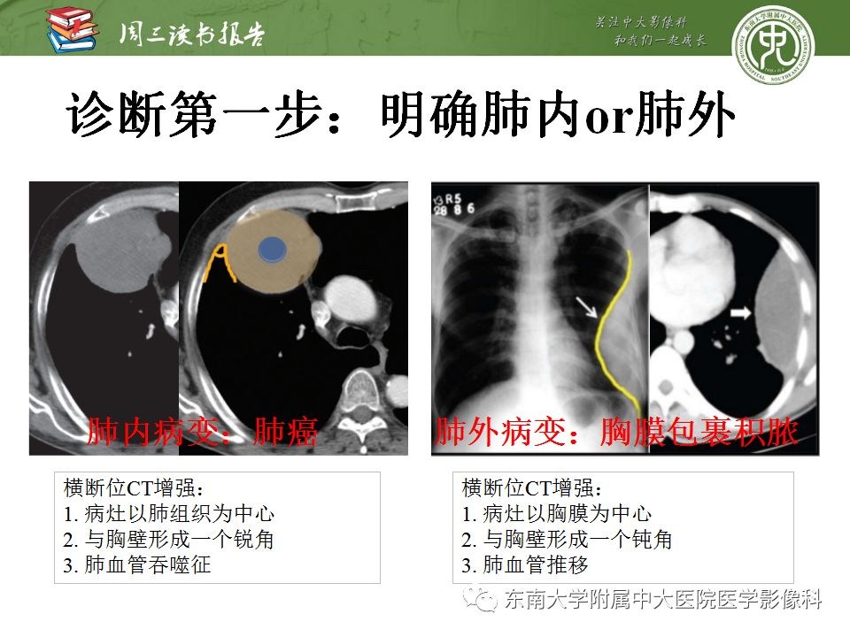 【PPT】胸膜常见疾病的影像诊断