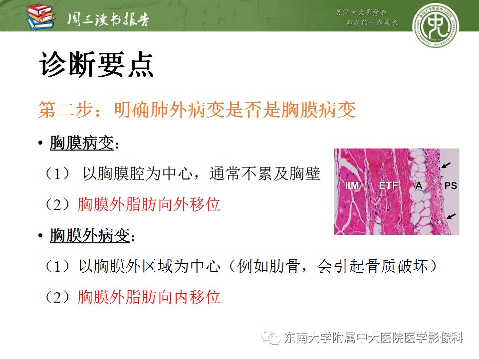 【PPT】胸膜常见疾病的影像诊断