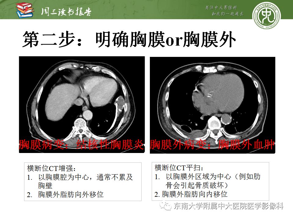 【PPT】胸膜常见疾病的影像诊断