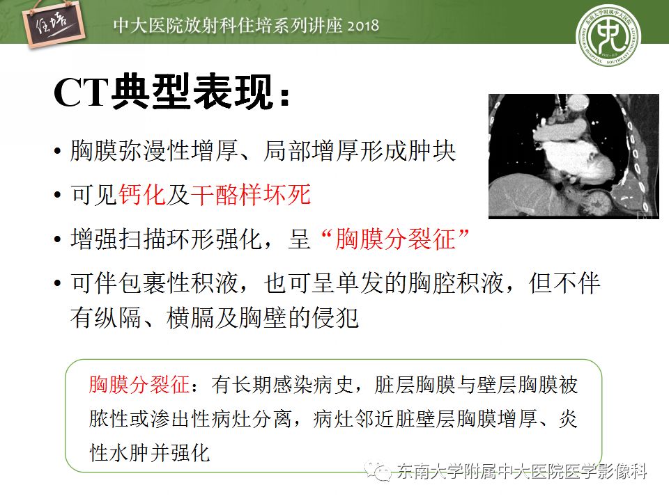 【PPT】胸膜常见疾病的影像诊断