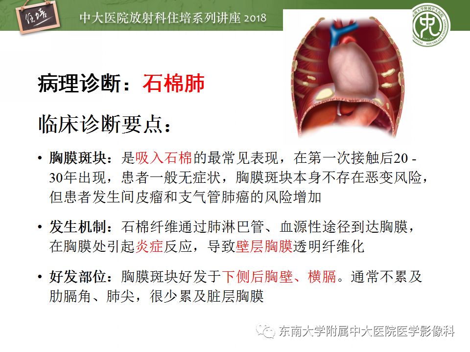 【PPT】胸膜常见疾病的影像诊断