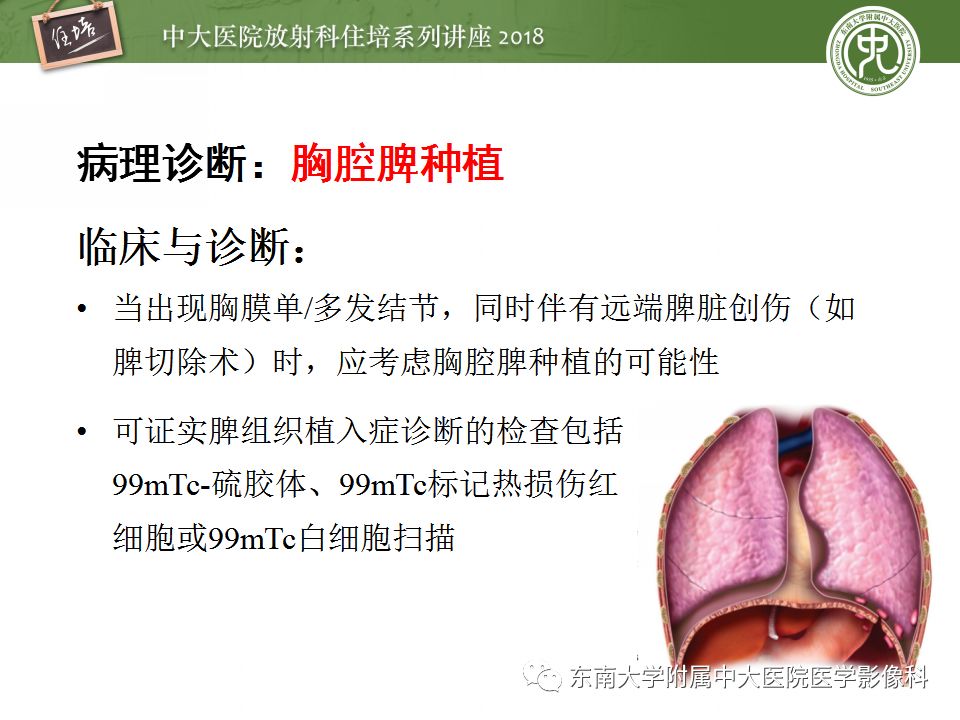 【PPT】胸膜常见疾病的影像诊断