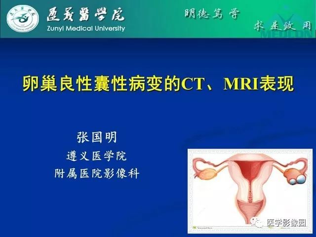 【PPT】卵巢良性囊性病变的CT、MRI表现