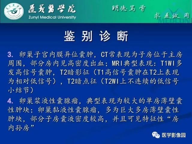 【PPT】卵巢良性囊性病变的CT、MRI表现