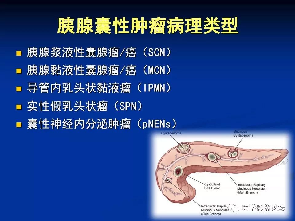 【PPT】胰腺囊性肿瘤影像学诊断与鉴别诊断