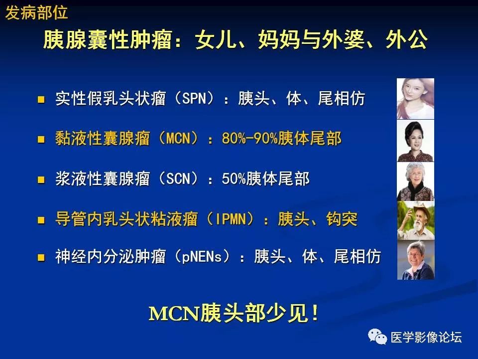 【PPT】胰腺囊性肿瘤影像学诊断与鉴别诊断