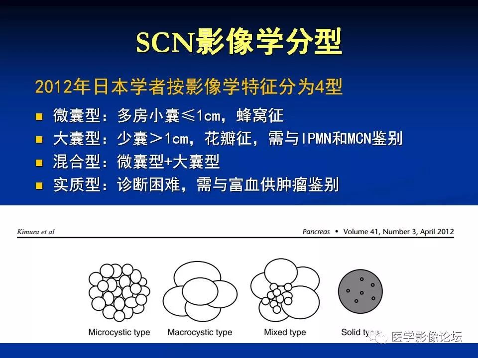 【PPT】胰腺囊性肿瘤影像学诊断与鉴别诊断