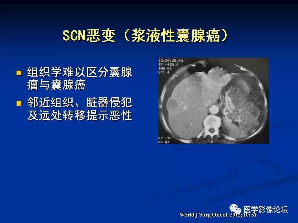 【PPT】胰腺囊性肿瘤影像学诊断与鉴别诊断