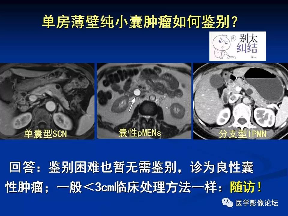 【PPT】胰腺囊性肿瘤影像学诊断与鉴别诊断