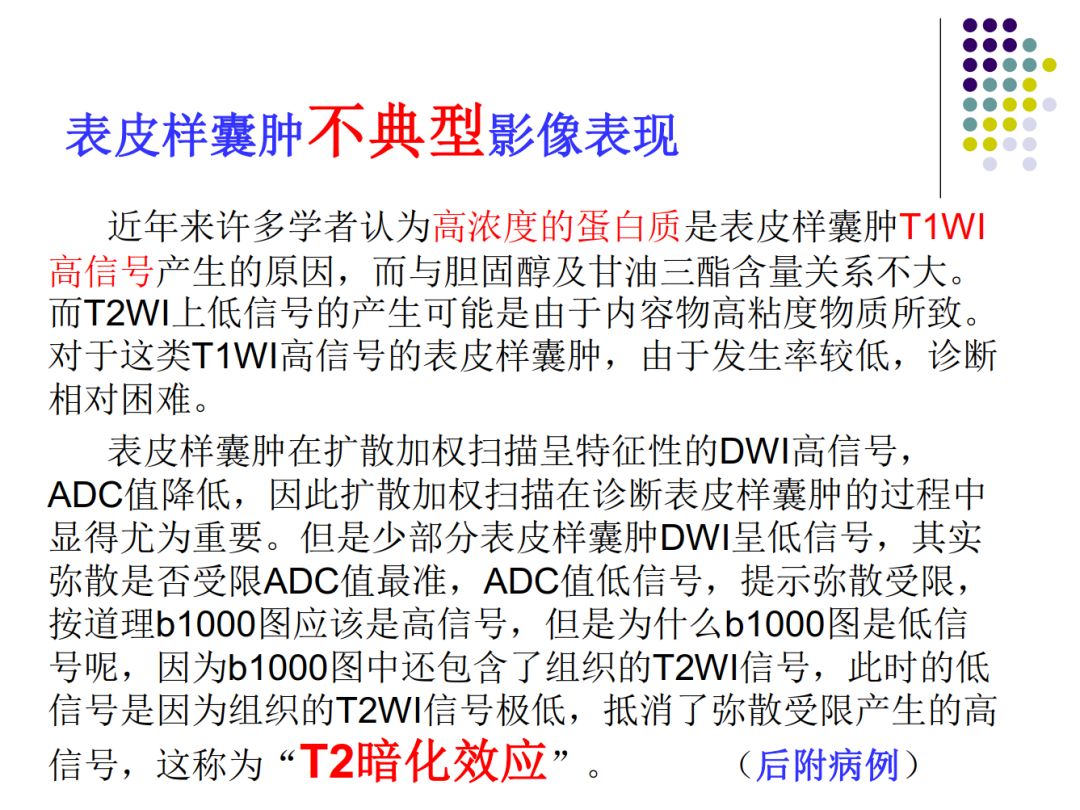【PPT】颅脑表皮样囊肿的影像学特征