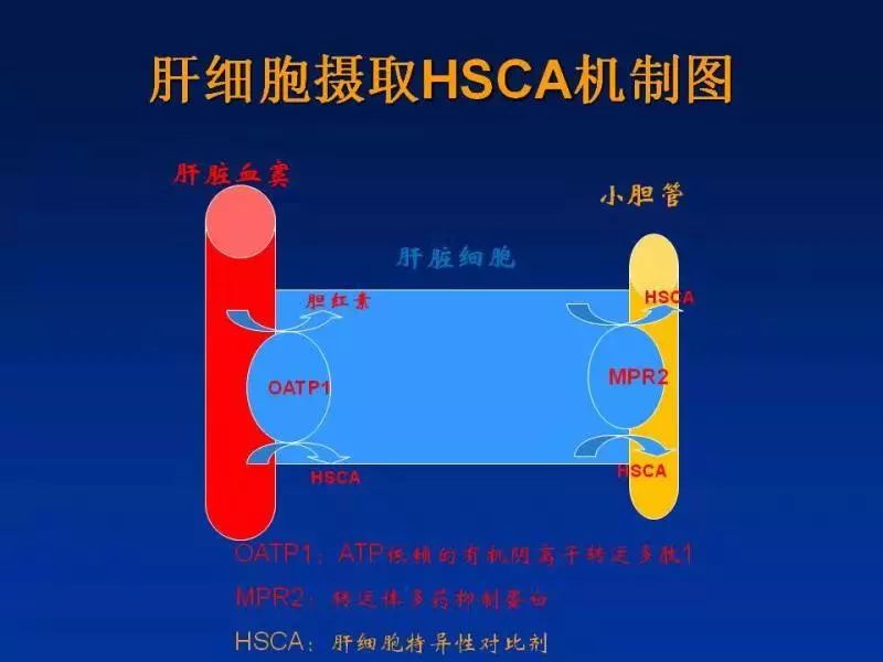 【PPT】肝细胞特异性对比剂临床应用