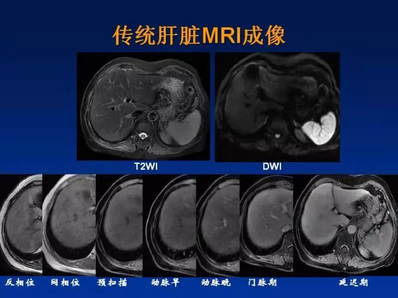 【PPT】肝细胞特异性对比剂临床应用