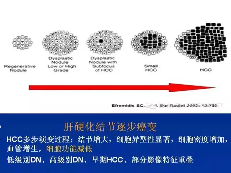 【PPT】肝细胞特异性对比剂临床应用