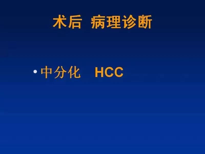 【PPT】肝细胞特异性对比剂临床应用