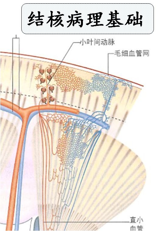 【PPT】肾脏炎性肉芽肿样病变影像表现
