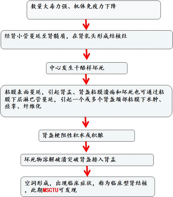 【PPT】肾脏炎性肉芽肿样病变影像表现