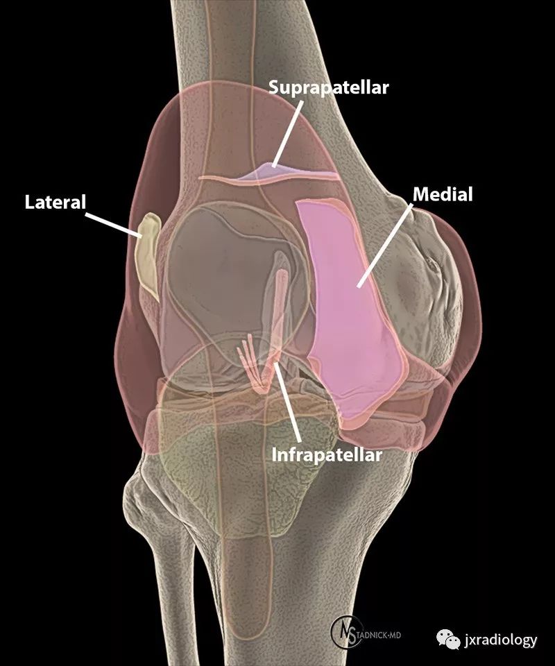 髌内侧滑膜皱襞综合征(Medial patellar plica syndrome, MPS) 髌内侧滑膜皱襞综合征(Medial patellar plica syndrome, MPS)