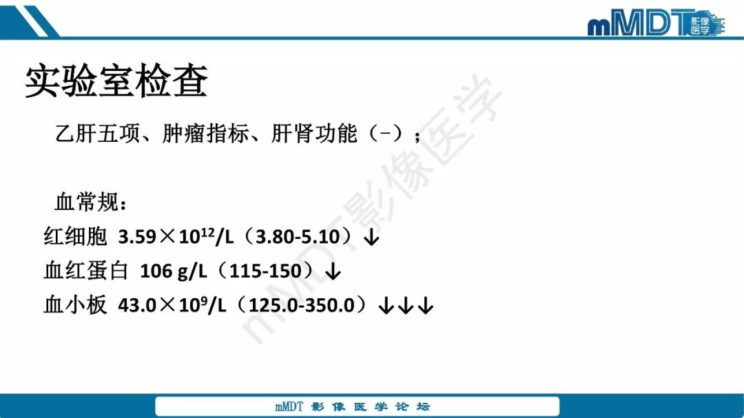 【病例】脾脏错构瘤1例病例解析