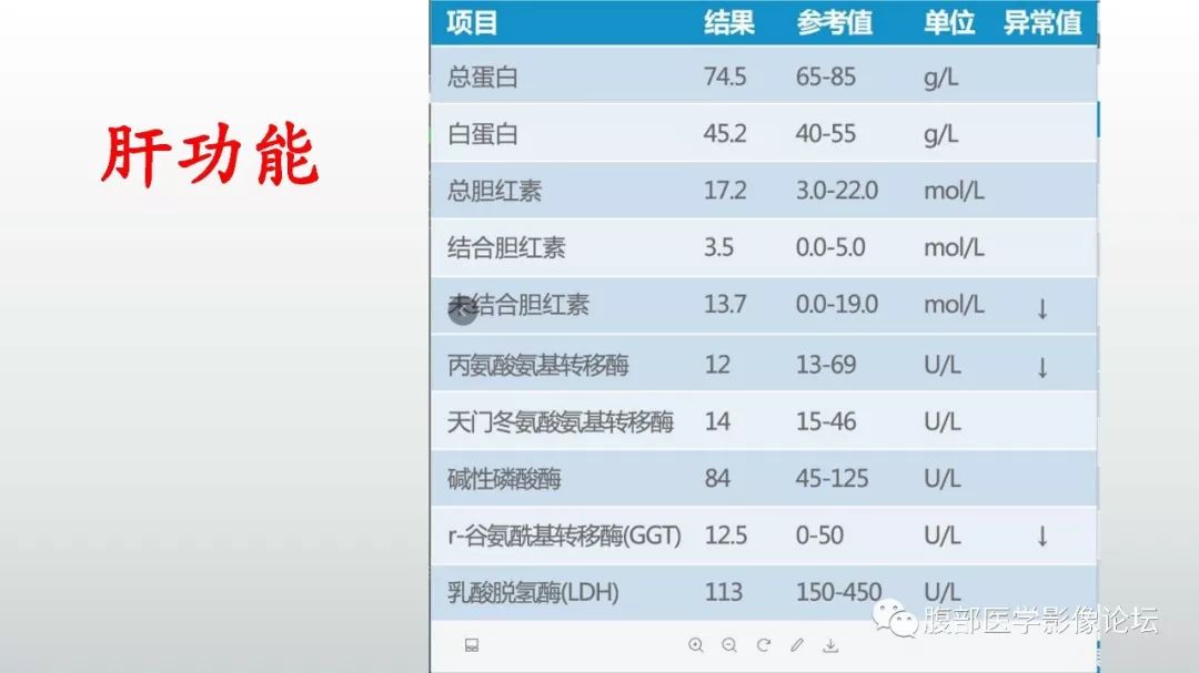 【病例】肝脏血管平滑肌脂肪瘤1例CT及MR影像诊断