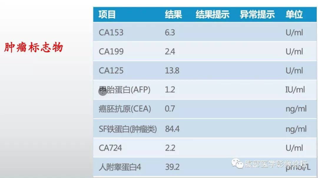 【病例】肝脏血管平滑肌脂肪瘤1例CT及MR影像诊断