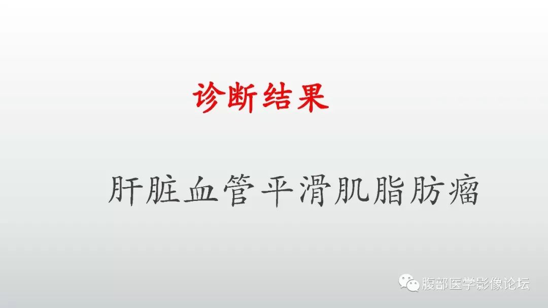 【病例】肝脏血管平滑肌脂肪瘤1例CT及MR影像诊断