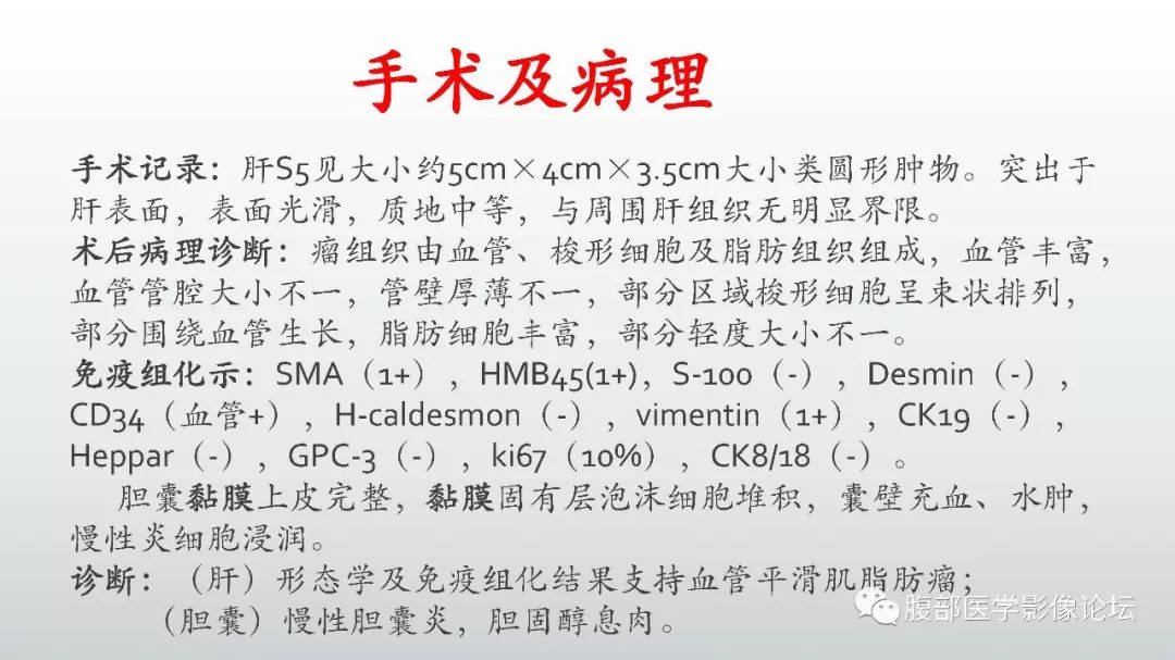 【病例】肝脏血管平滑肌脂肪瘤1例CT及MR影像诊断