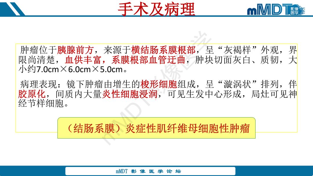 【病例】腹腔炎性肌纤维母细胞瘤1例CT病例读片分析