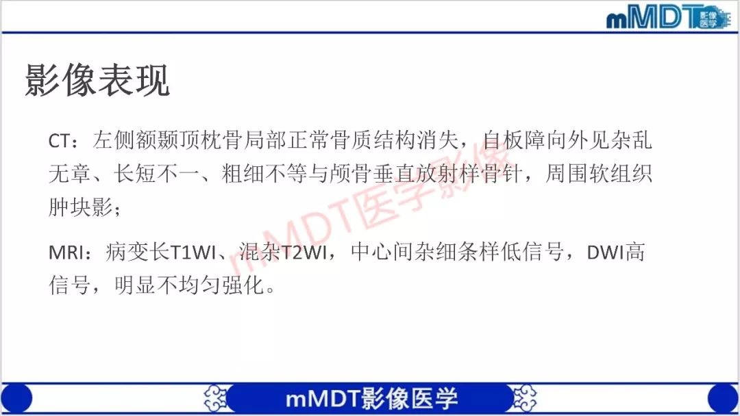 【PPT】颅骨“放射样”骨针的影像诊断