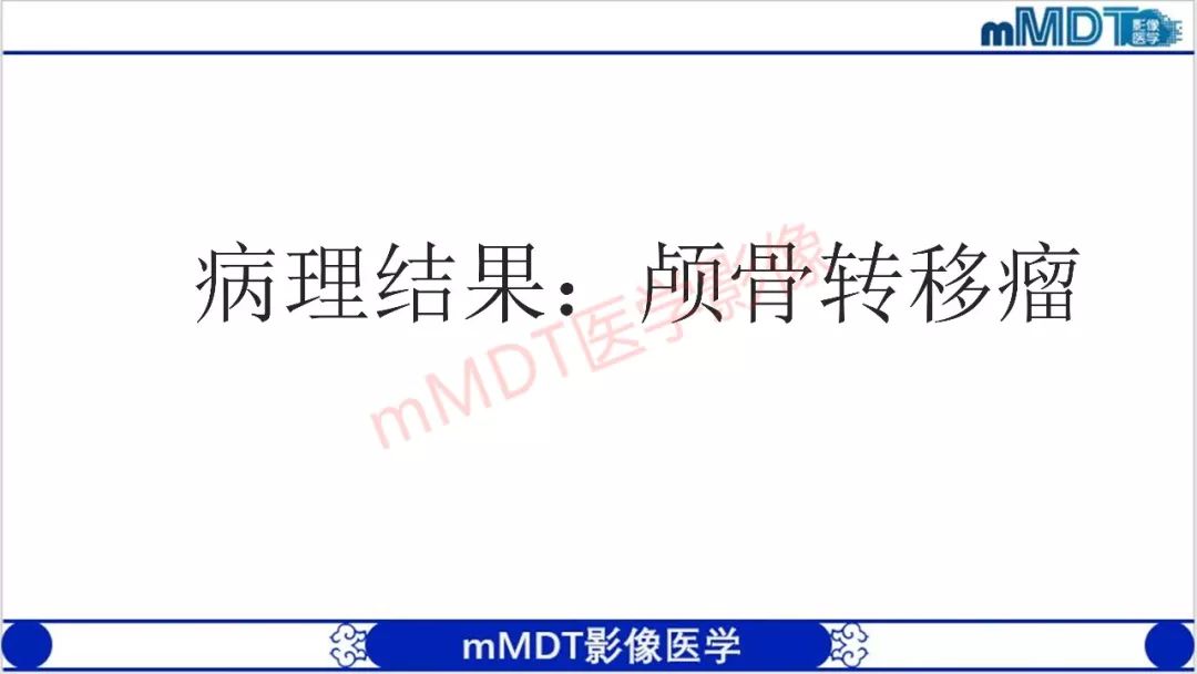 【PPT】颅骨“放射样”骨针的影像诊断