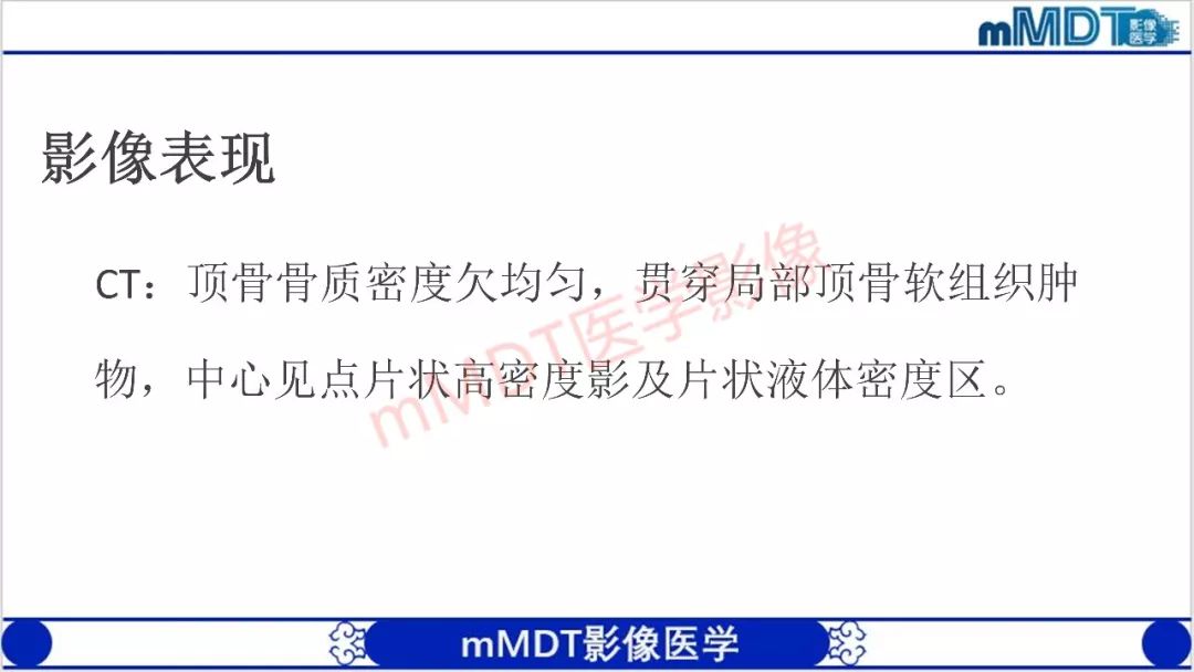 【PPT】颅骨“放射样”骨针的影像诊断