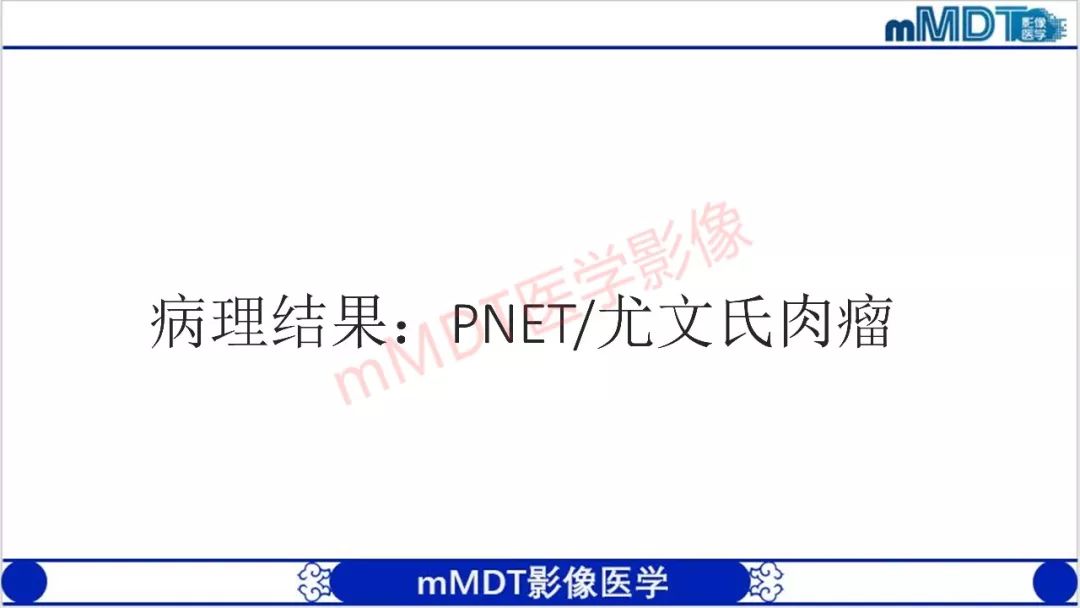 【PPT】颅骨“放射样”骨针的影像诊断