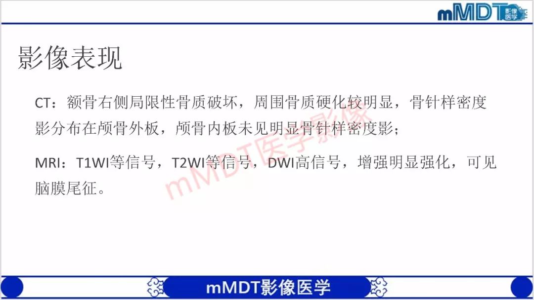 【PPT】颅骨“放射样”骨针的影像诊断