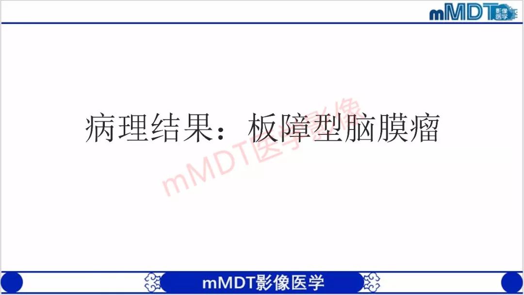 【PPT】颅骨“放射样”骨针的影像诊断