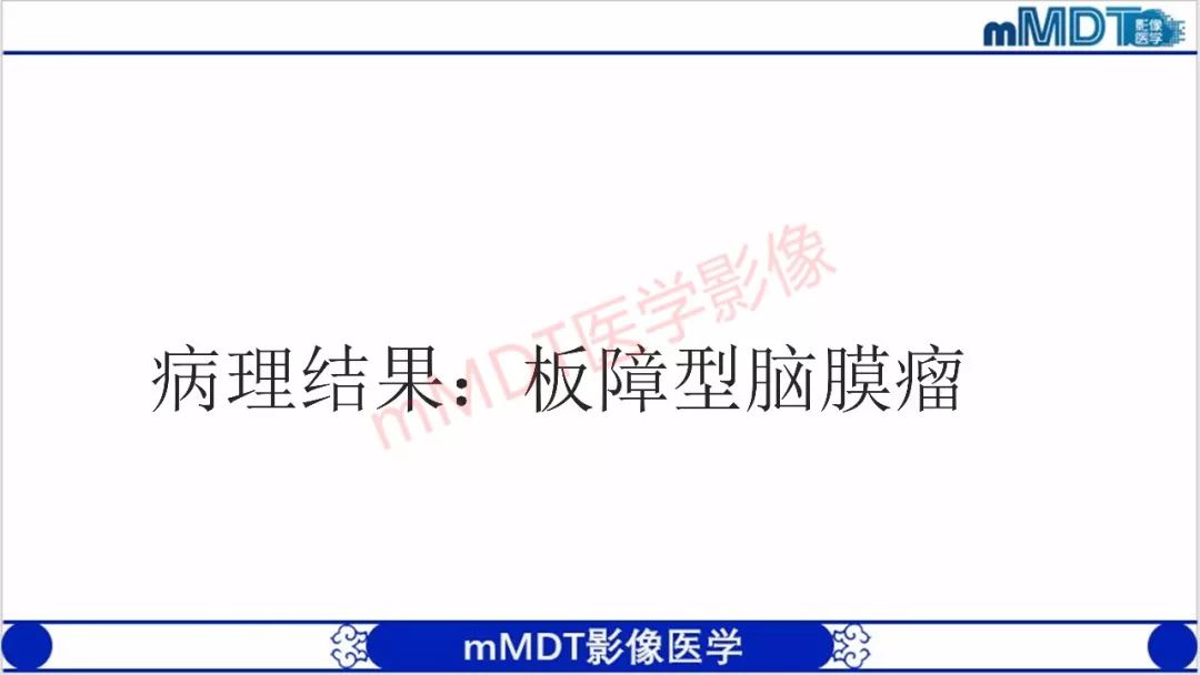 【PPT】颅骨“放射样”骨针的影像诊断